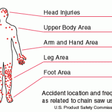 Chainsaw-Injury-Locations